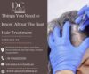 Hair Transplant in Zirakpur