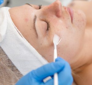 Best skin specialist in Zirakpur