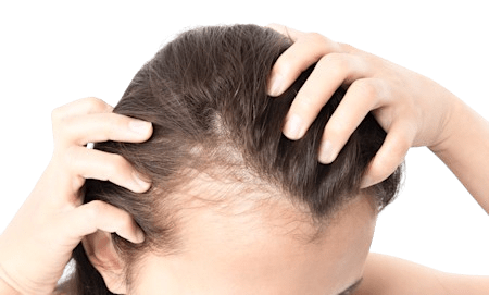 GFC Hair Treatment in Zirakpur
