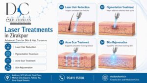 Laser Treatments in Zirakpur
