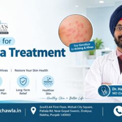 Urticaria Treatment in Zirakpur: Causes, Symptoms and Treatment Options