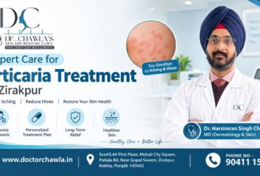 urticaria treatment in Zirakpur