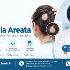How to Treat Alopecia Areata: Expert Guide