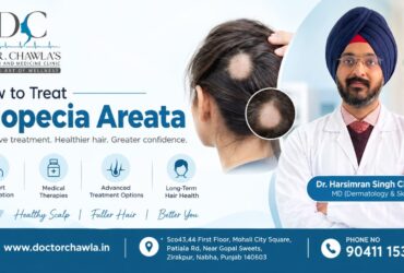 How to Treat Alopecia Areata